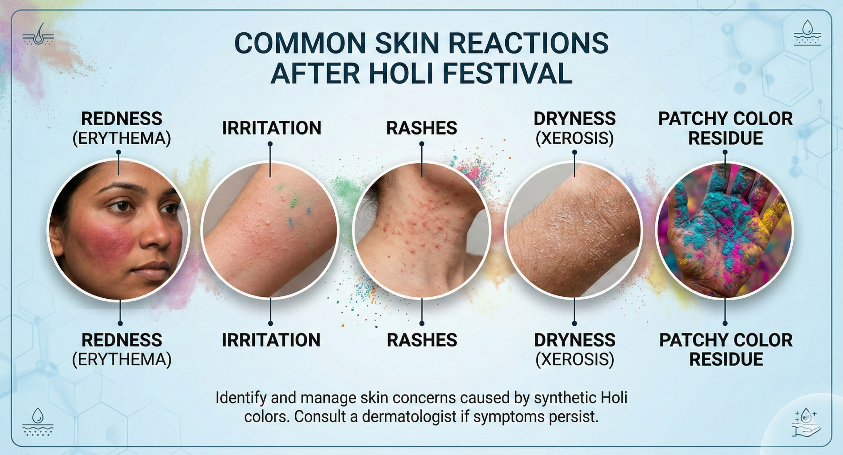 Holi Color Powder Skin Problems